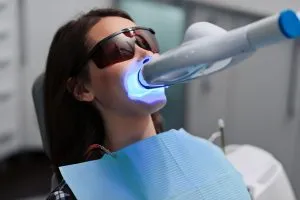 best teeth whitening Studio G Dentist Chapel Hill